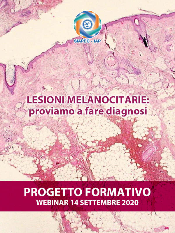 Programma Webinar Progetto formativo sulle lesioni melanocitarie – Impariamo a fare diagnosi